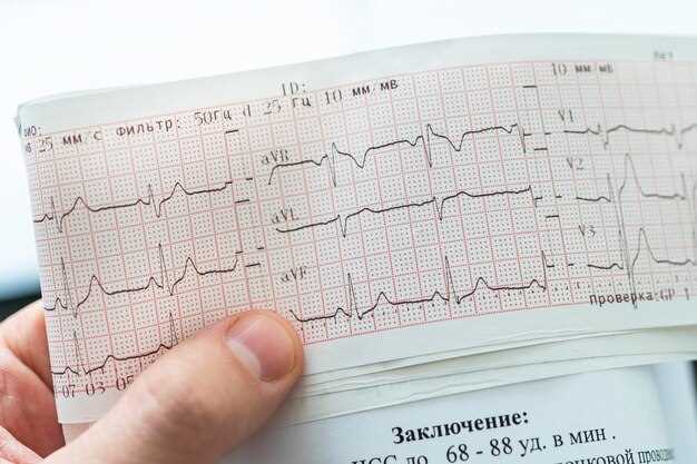 Рекомендации по применению Бисопролола при тахикардии